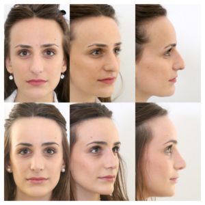 marilou 300x300 marilou